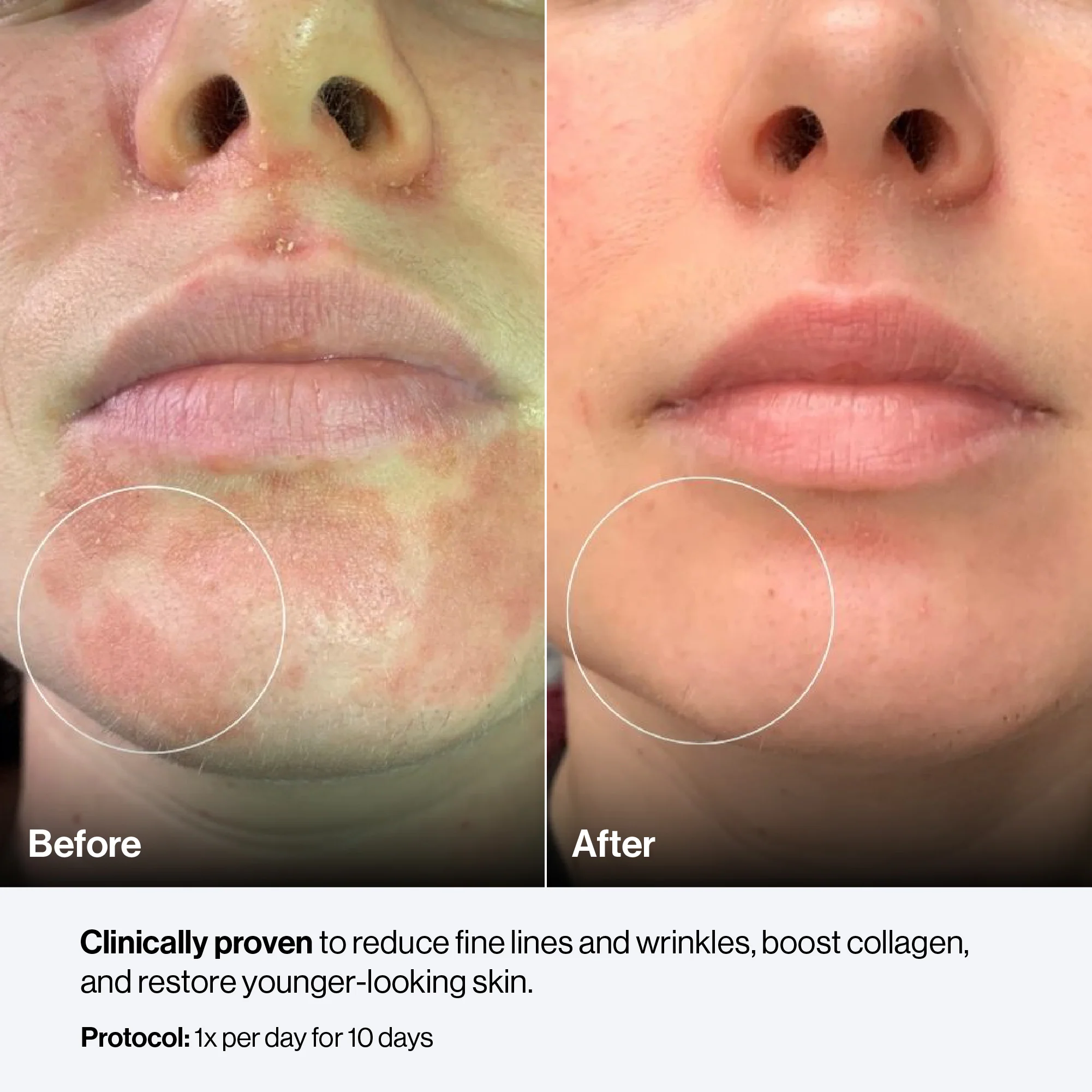 Thumbnail 21